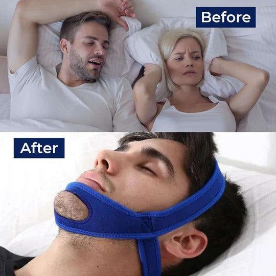 Adjustable Chin Strap with Full Head Coverage for Sleep Positioning